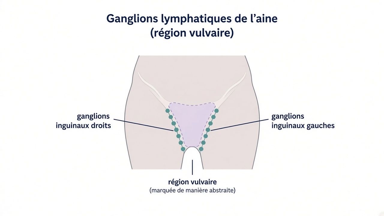 Ganglions inguinaux : drainage lymphatique de la vulve.