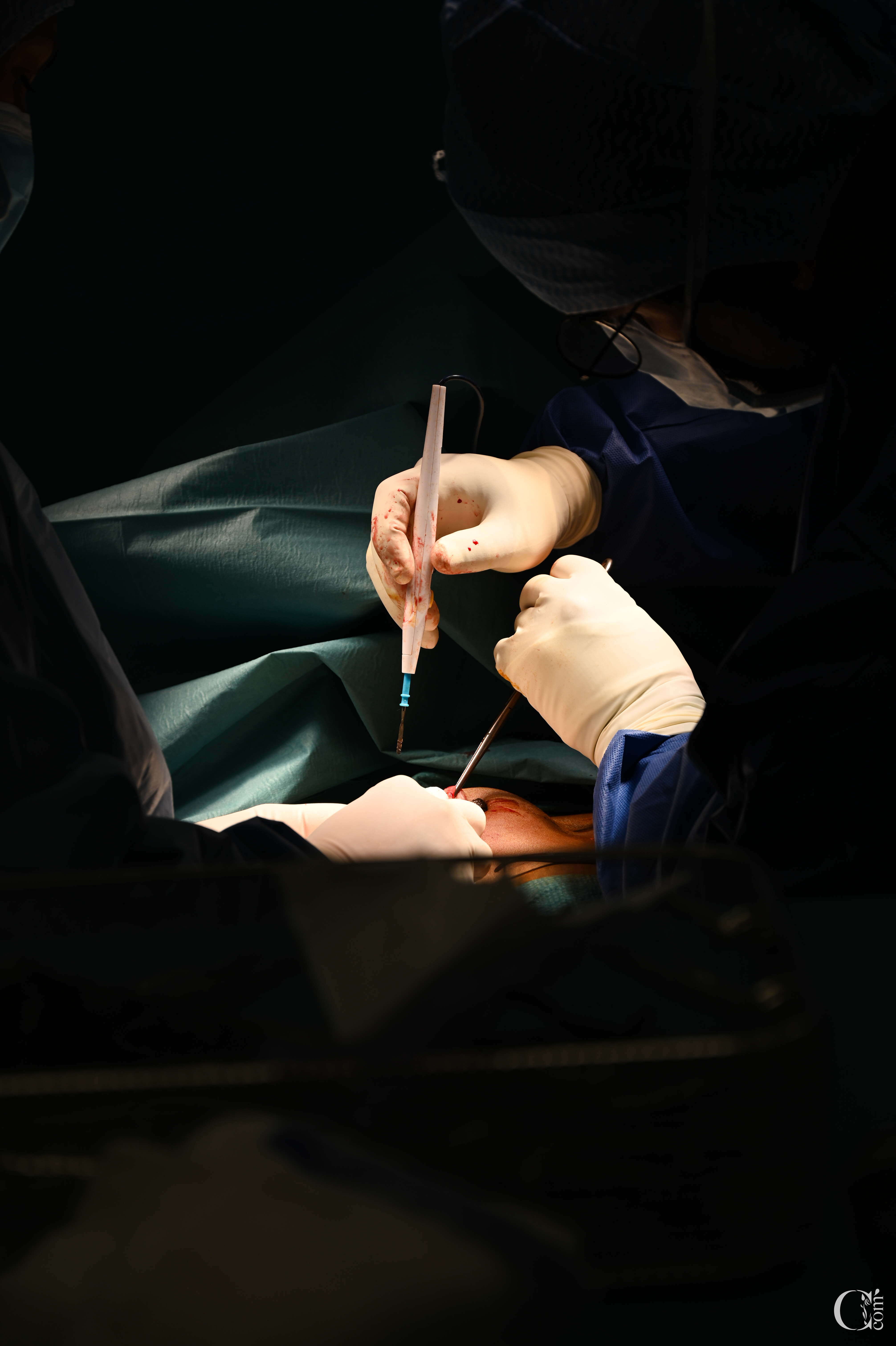 Dr Jérémie Zeitoun au bloc opératoire — mastectomie prophylactique Paris
