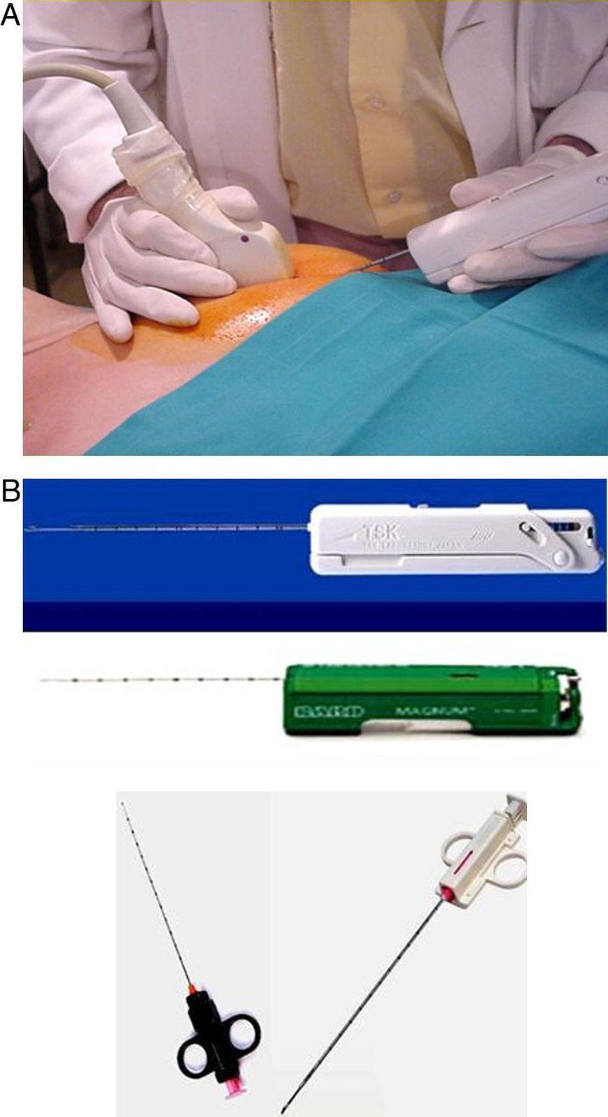 Aiguilles et pistolets de biopsie mammaire