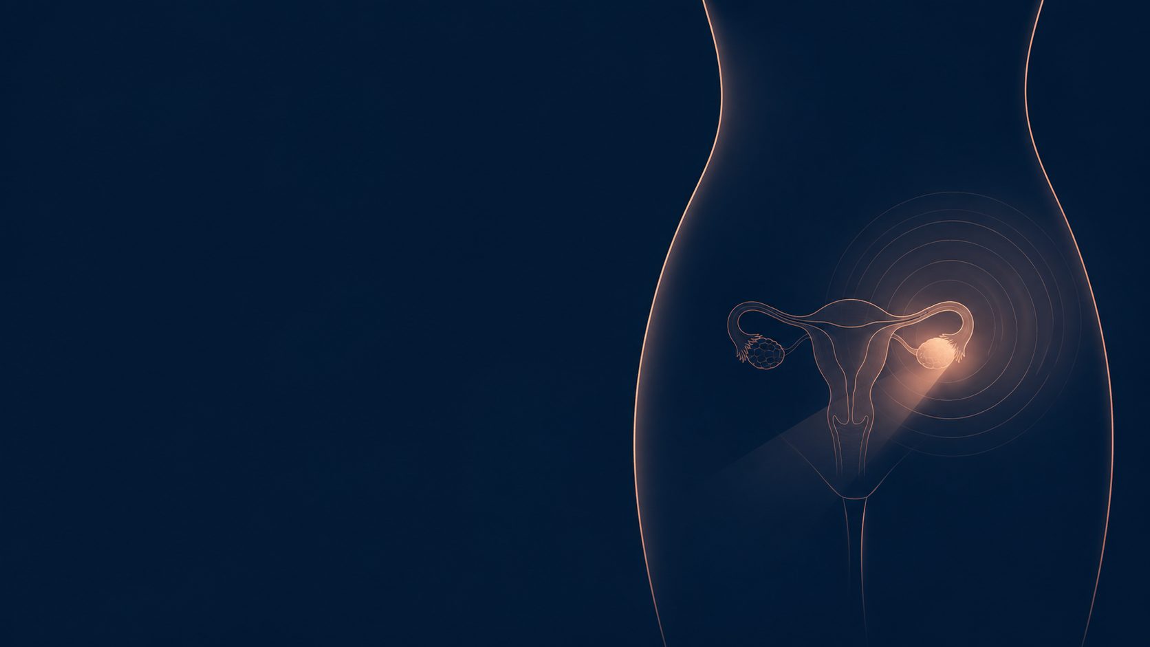 The pathway after a persistent sign: from listening to the signs to clinical examination, pelvic ultrasound, CA-125 testing and a specialist surgical opinion once a mass has been identified — Dr Jérémie Zeitoun Paris