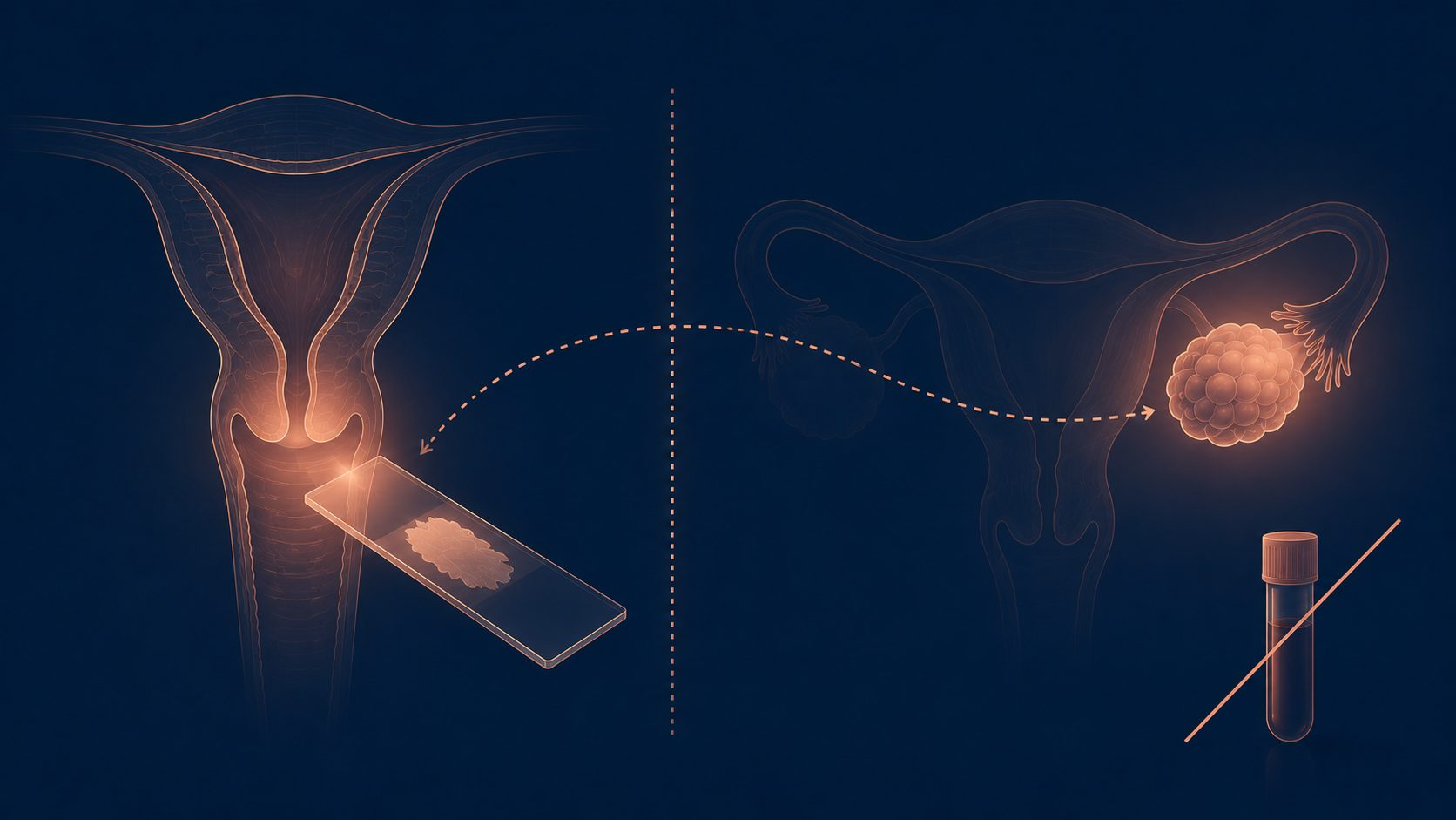 Signs that may alert: bloating, pelvic pain, early satiety, frequent urination — especially when new, persistent and frequent — Dr Jérémie Zeitoun Paris