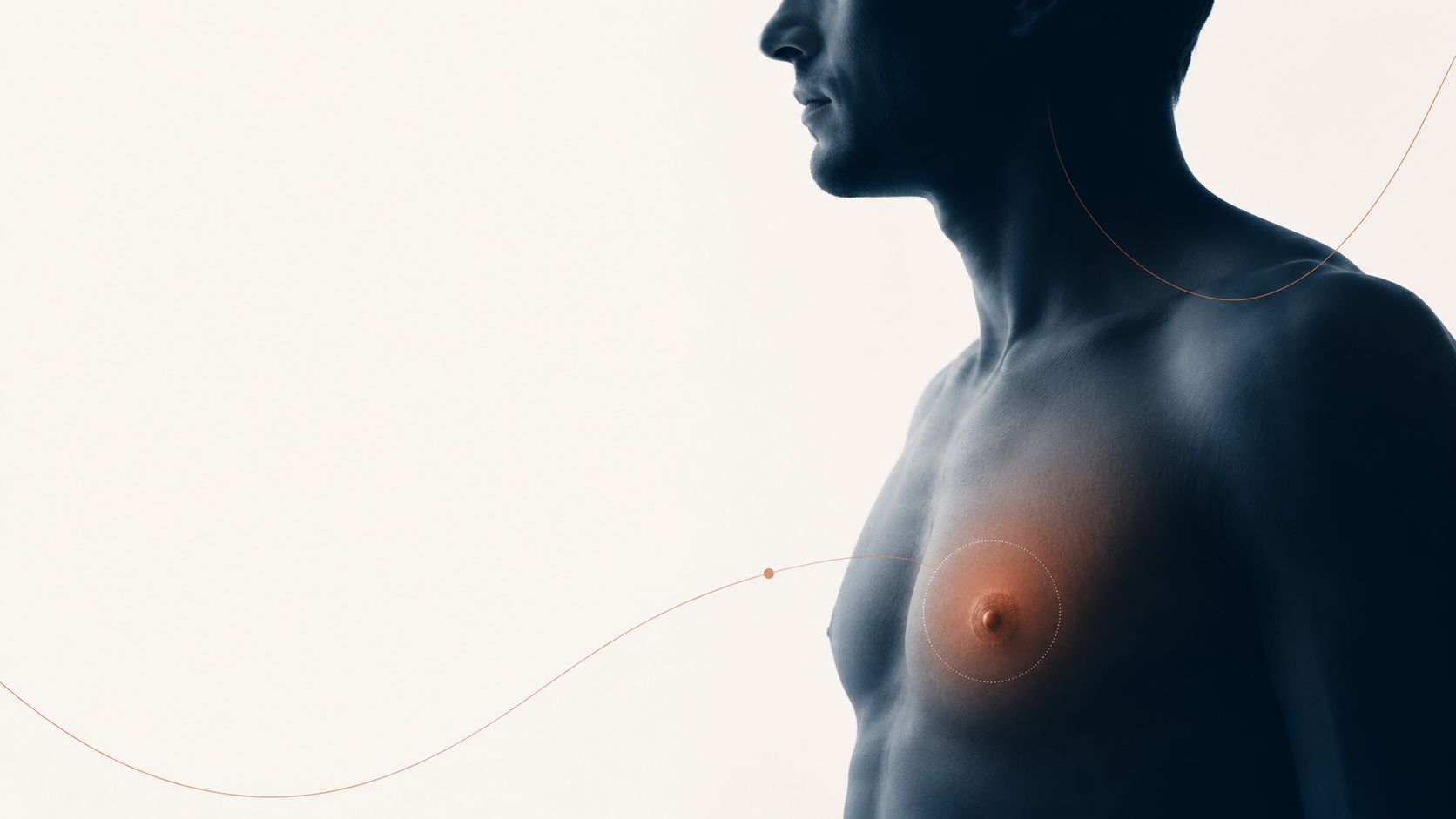 Cancer du sein chez l'homme : boule rétro-aréolaire, diagnostic par mammographie et biopsie, chirurgie par mastectomie — Dr Jérémie Zeitoun, chirurgien sénologue Paris