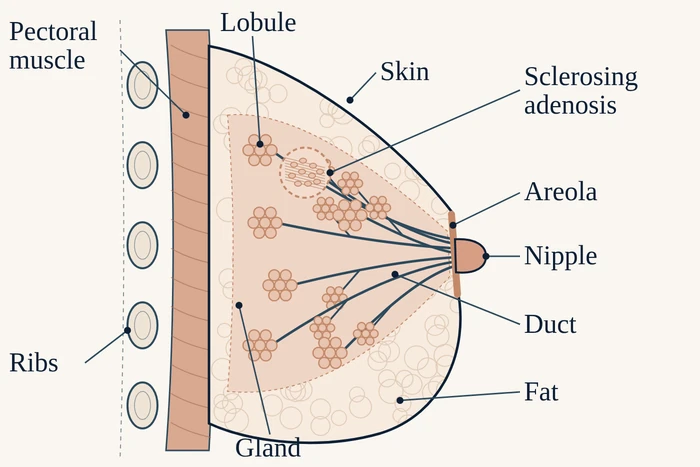 Side view of the breast: muscle, lobules, ducts converging on the nipple, fat, and an area of sclerosing adenosis within a lobule.