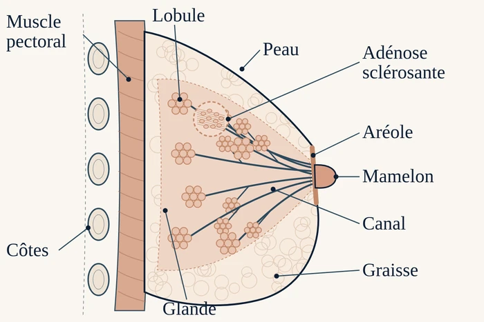 Coupe du sein vue de profil : muscle, lobules, canaux convergeant vers le mamelon, graisse, et une zone d'adénose sclérosante dans un lobule.