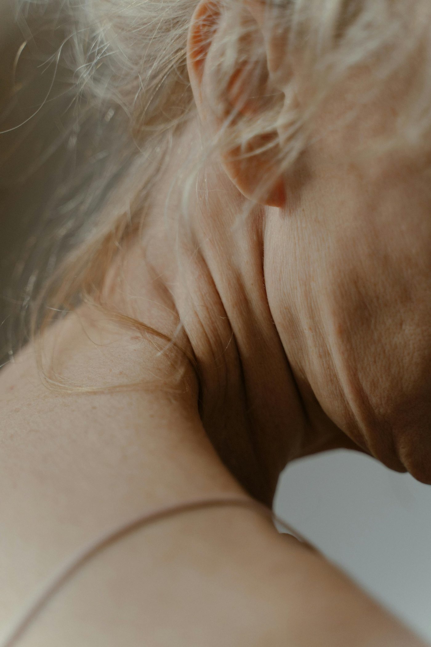 Ganglion sentinelle ou curage axillaire — désescalade