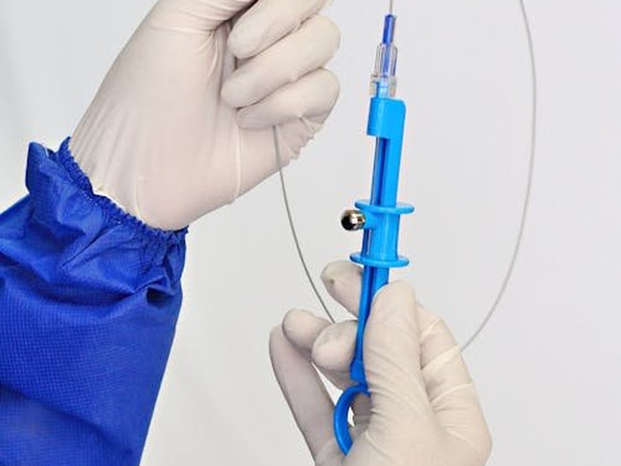Uterine artery embolization — interventional radiology technique that cuts off the fibroid's blood supply