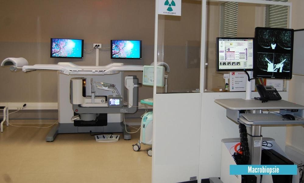 Salle de macrobiopsie stéréotaxique sous mammographie