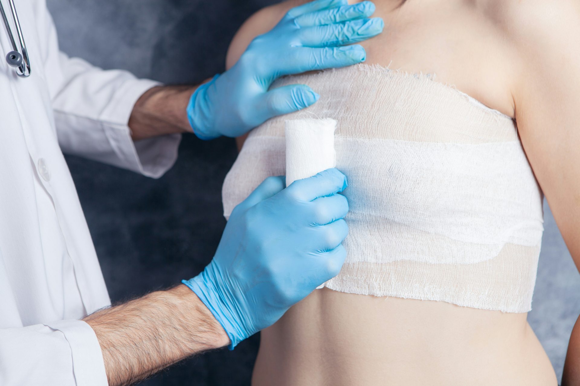 Mastectomie pour tumeur phyllode volumineuse