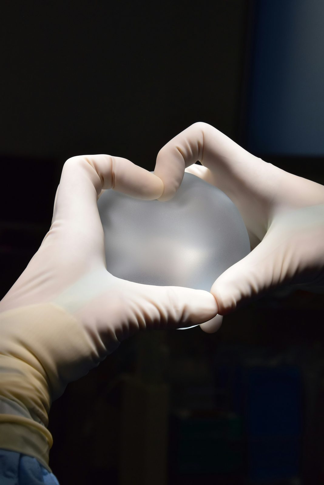 Cohesive silicone gel breast implant held by surgeon's hands — gold-standard material for implant-based breast reconstruction after mastectomy, Dr Jérémie Zeitoun breast surgeon Paris 8th Clinique Hartmann