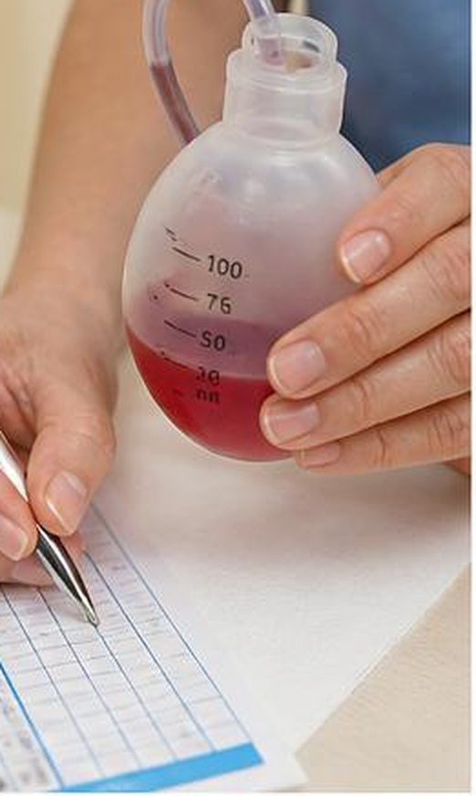 Daily recording of drain volume and fluid colour on monitoring chart — graduated 100 mL Redon bottle, post-operative nursing follow-up, Dr Jérémie Zeitoun breast surgical oncologist Paris